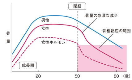 年齢と閉経にともなう骨量の変化(概念図)